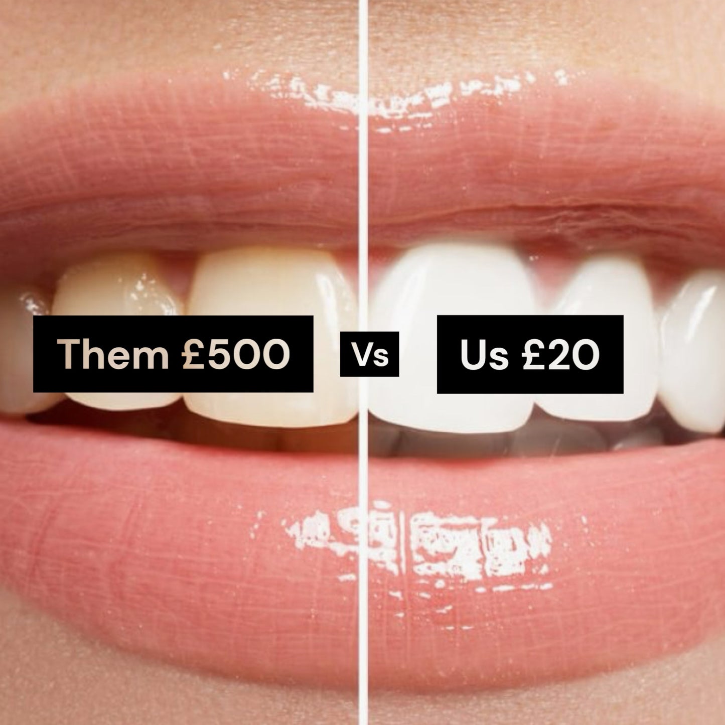Unbranded™ - Same as Crest Teeth Whitening Strips
